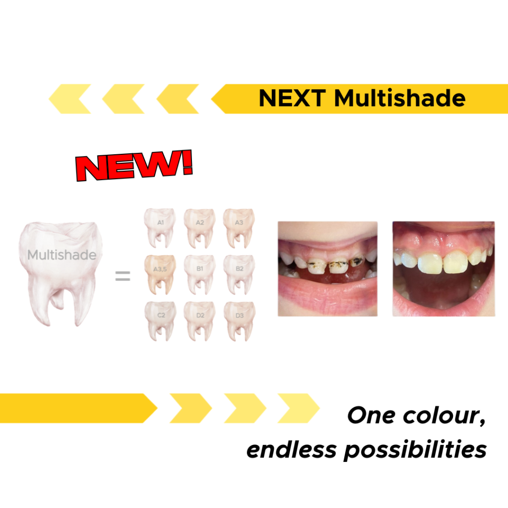 NEXT MULTISHADE