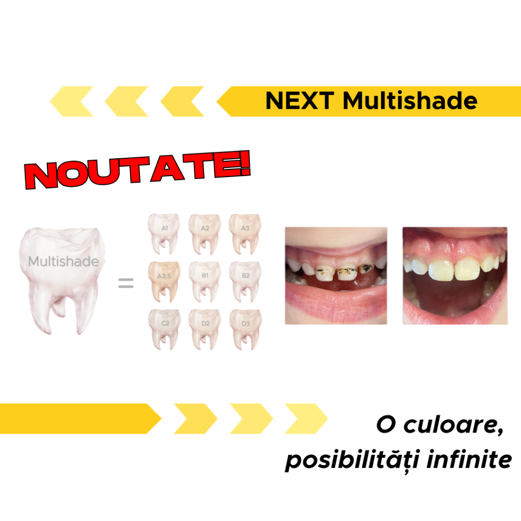 next multishade