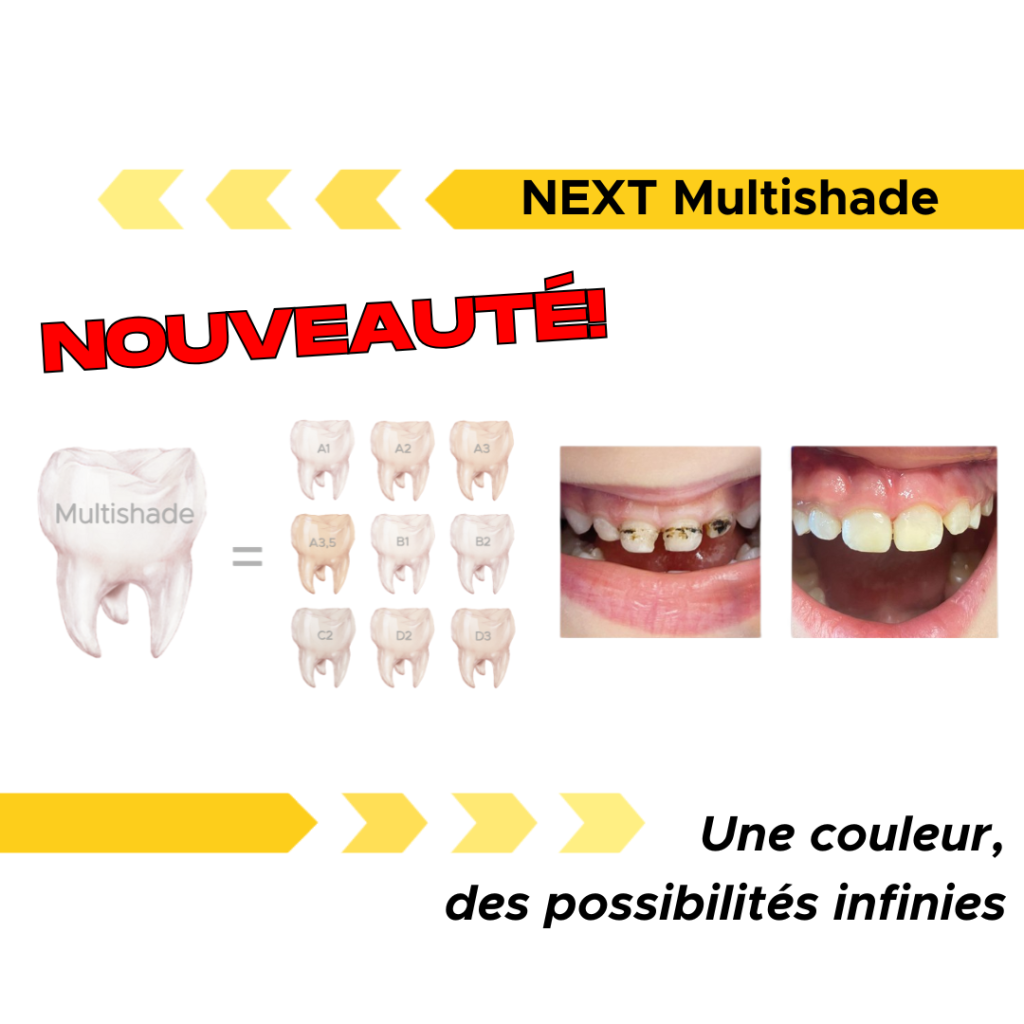 next multishade